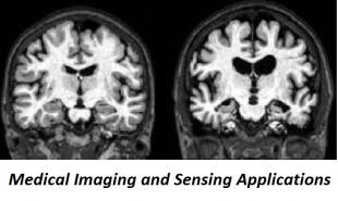Medical Imaging and Sensing Applications